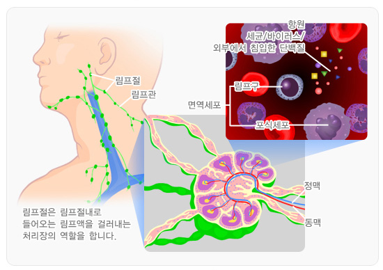 경부림프절염