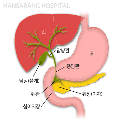 안산한사랑병원 담낭