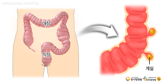 대장게실